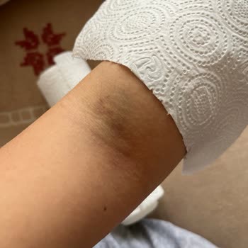 Medical Park Maltepe Acil Birimi