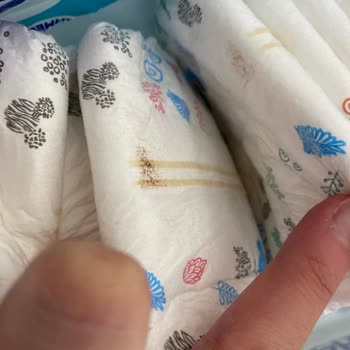 Goon Bebek Bezinde Kahverengi Lekeler