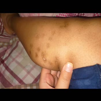 Estemed Lazer Estetik Tekirdağ'daki Lazer Kliniğinde Yaşanan Mağduriyet