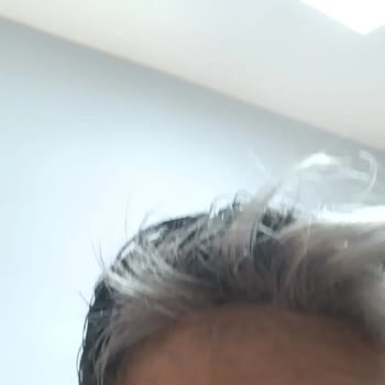 Hair Life Protez Saç Firmasından Şikayetçiyim