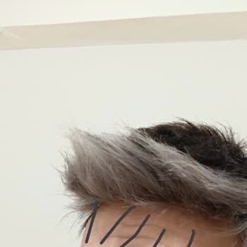 Hair Life Protez Saç Firmasından Şikayetçiyim