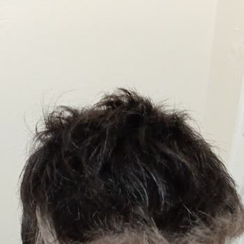 Hair Life Protez Saç Firmasından Şikayetçiyim