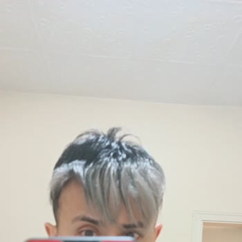 Hair Life Protez Saç Firmasından Şikayetçiyim