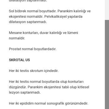 Bursa Çekirge Devlet Hastanesi Sonuçlar Dikkatli İncelenmiyor
