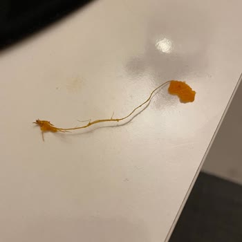 Lays Paketinden İp Çıktı!