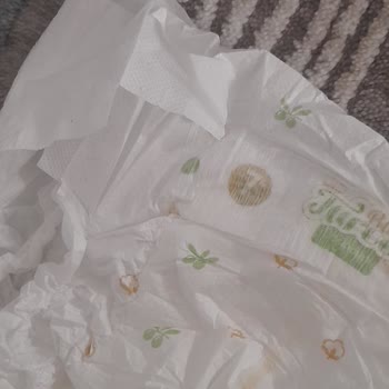 Baby Turco 7 No Hatalı Bez