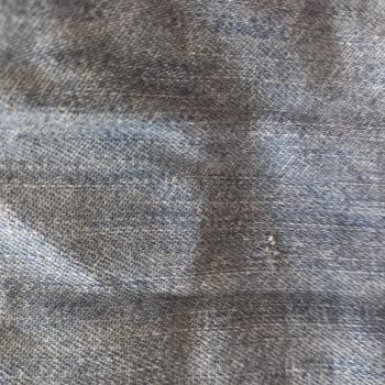 Zara Online Mağazasından Alınan Kot Gömleğin Defolu Gönderilmesi