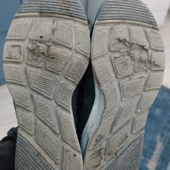 Skechers Spor Ayakkabı Mağduriyeti Hakkında