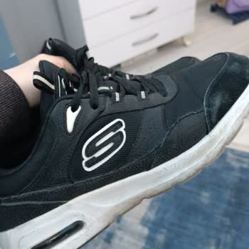 Skechers Spor Ayakkabı Mağduriyeti Hakkında