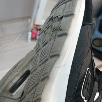 Skechers Spor Ayakkabı Mağduriyeti Hakkında