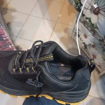 2 Ayda Deforme Oldu Skechers