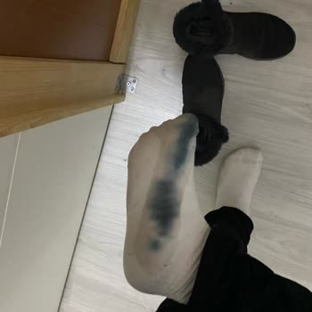 Skechers Alınmaz Tavsiye Edilmez Pazar Malı Daha İyi