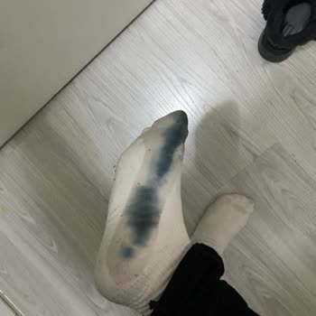 Skechers Alınmaz Tavsiye Edilmez Pazar Malı Daha İyi