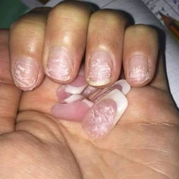 Merve Ünalır Güzellik Merkezi Protez Tırnak Pişmanlığı