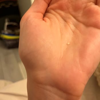 Ruffles Mangal Tadında Cipsin İçinden Çıkan Yabancı Madde