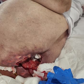 Gönül Yılmaz Huzurevi ve Yaşlı Bakım Merkezi Yaşlı Bakım Merkezleri İle İlgili Değerlendirme