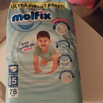 Molfix Yeni Teknoloji Yeni Sinir Krizleri.