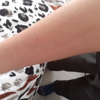 Nesquik Toz İçecek Çocuğumu Hastanelik Etti