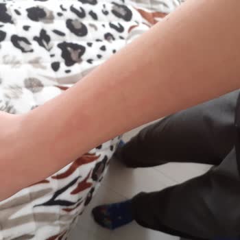 Nesquik Toz İçecek Çocuğumu Hastanelik Etti