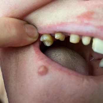 Akdeniz Üniversitesi Hastanesi Akdeniz Üni Diş Hastanesi Sorumsuzluğu