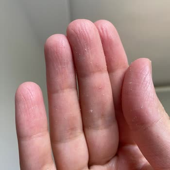 Neutrogena El Kremi Pütür Pütür Oluyor Ve Emilmiyor!
