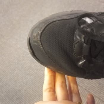 Skechers Ayakkabımın Önü Açıldı.