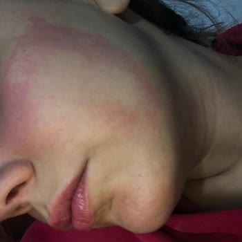 Claderm Kil Maskesi Rezil