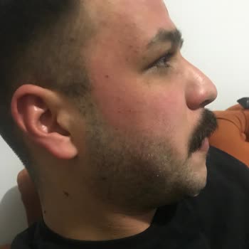 Claderm Kil Maskesi Rezil
