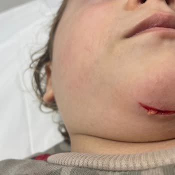 Zuzu Park Çocuğum Parkta Yaralandı, İlgisizlik Üzdü!