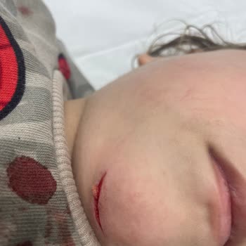 Zuzu Park Çocuğum Parkta Yaralandı, İlgisizlik Üzdü!