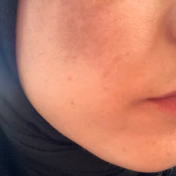 Sevim Alan Güzellik Merkezi Derdim Para Değil, Yüzüm İçin Çare Aramak