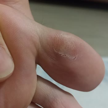 FLO Ayakkabı Hatalı Ürün Ama Kabul Edilmiyor