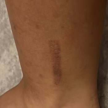 Liparis Güzellik Salonu İzmir Güzellik Salonu Pişmanlığı