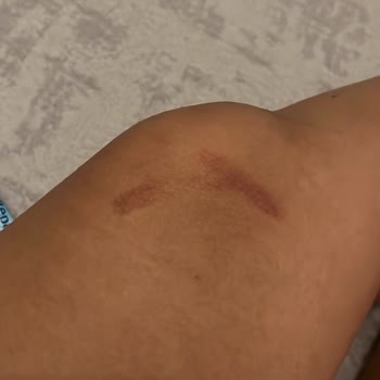 Liparis Güzellik Salonu İzmir Güzellik Salonu Pişmanlığı