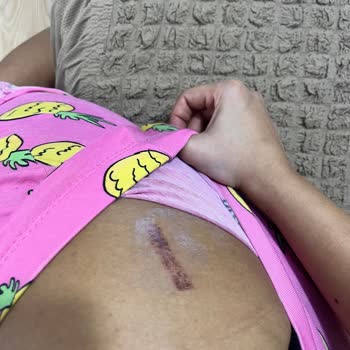 Liparis Güzellik Salonu İzmir Güzellik Salonu Pişmanlığı