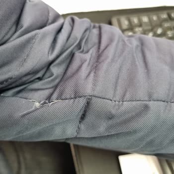 Lufian Montta Tüyler Çıkıyor Aşınma Oluyor Yardımcı Olmuyor Lufian