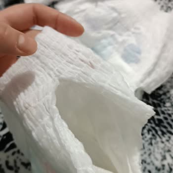Molfix Külot Bez Yırtılıyor Sağlam Değil