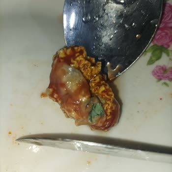 Şok Marketler Ketçabın İçinden Küflü Beyin Çıktı