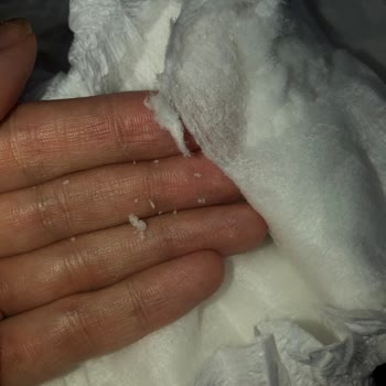 Sleepy Natural Ve Extra Bebek Bezi Yapısının Bozulması