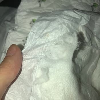 Sleepy Natural Ve Extra Bebek Bezi Yapısının Bozulması