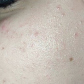 Cream Co Nemlendirici İadesi İstiyorum