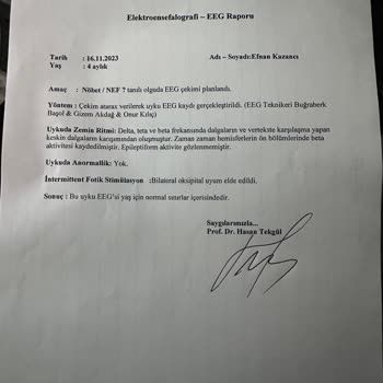 Dokuz Eylül Üniversitesi Tıp Fakültesi Yanlış Tanı Reflü Yü Epilepsi Diyerek Ağır İlaçlara Maruz Bırakıldık