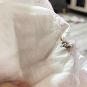 Sleepy Natural Bezin İçinden Yabancı Cisim Çıktı