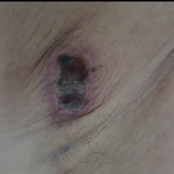 Alanya Suit Güzellik Merkezi Nin Güzellikleri...