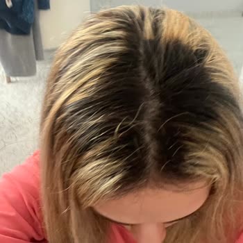 Deha Kuaför Ve Güzellik Salonları Etlik Saçı Yaktılar!
