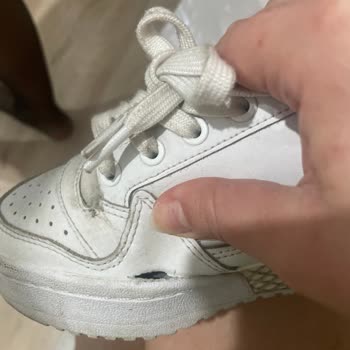 adidas SuperStep Satışını Yaptığı Üretim Kaynaklı Ürünlere Çözüm Sunmuyor!