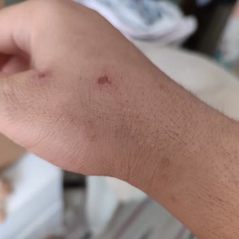 Edis Pharma İlaç Xabion Uyuz Losyonu