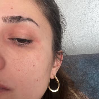 Watsons Sağlığımı Önemsemedi Başından Savdı