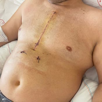 Sağlık Bakanlığı İzmir Yeşilyurt Araştırma Devlet Hastanesi