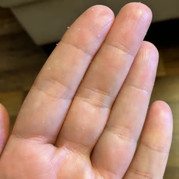 Neutrogena Hand&Nail Topaklanma, Dökülme Ve Ciltte Hassaslık Problemi